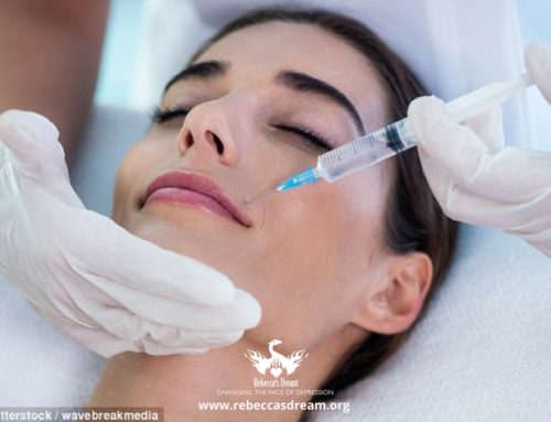 Can Botox Cure Depression?